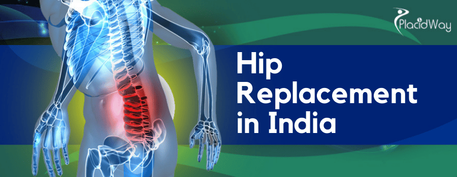 Hip Replacement Surgery in India - Cost & Packages